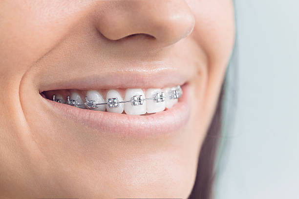 Best Traditional Braces  in Prineville, OR